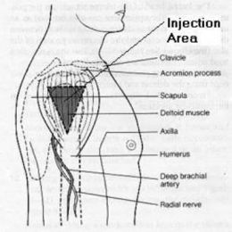 Injection Area