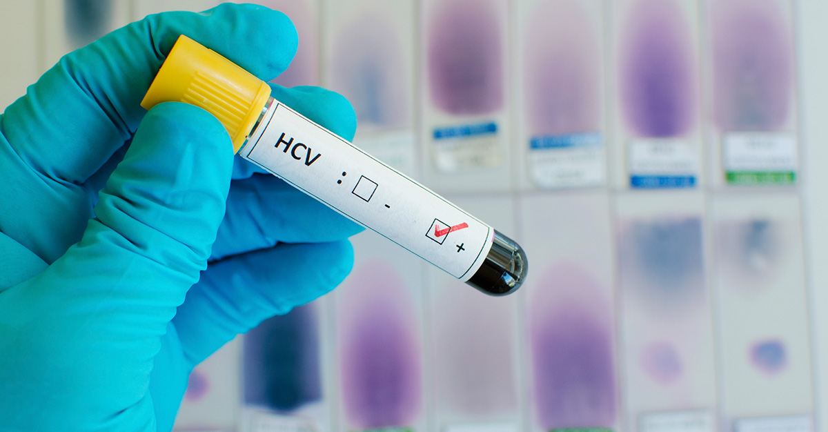 Hepatitis titer testing