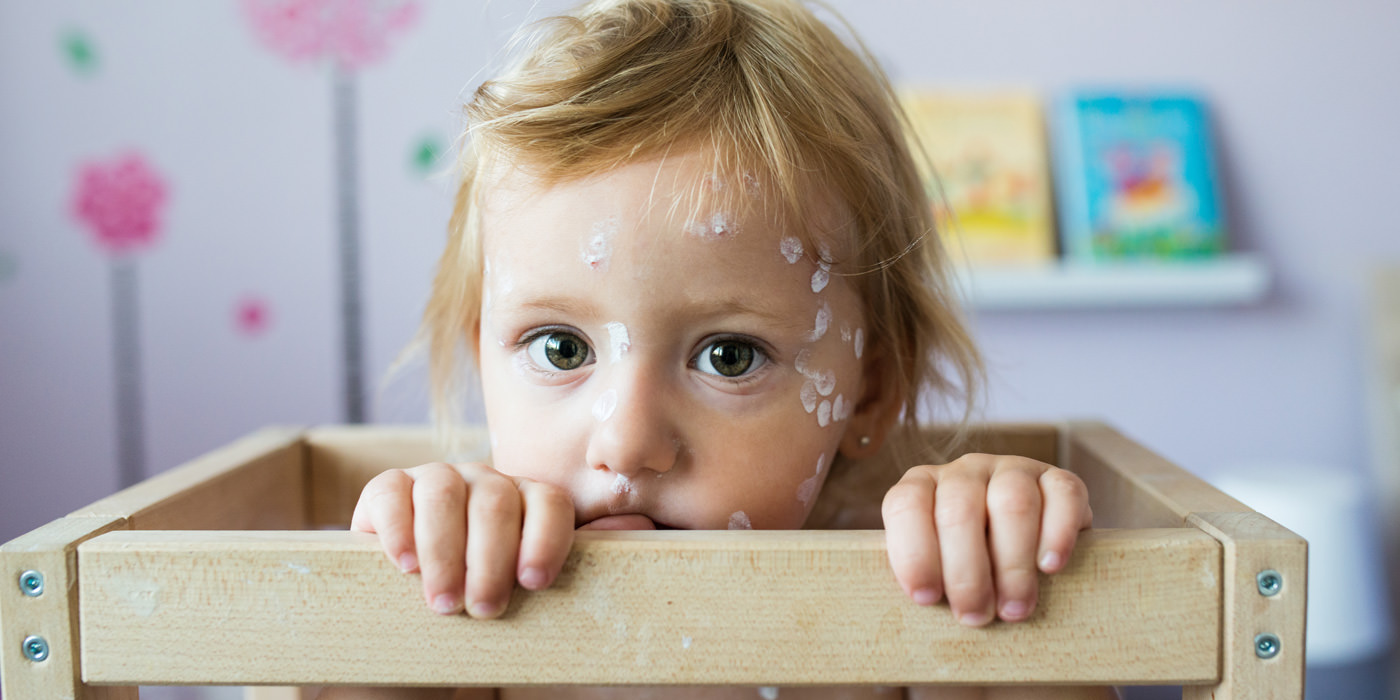 Chickenpox can be a very dangerous disease. Make sure your family is protected.