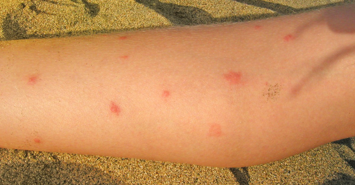 Chikungunya is now on the Tropical Disease Priority List.