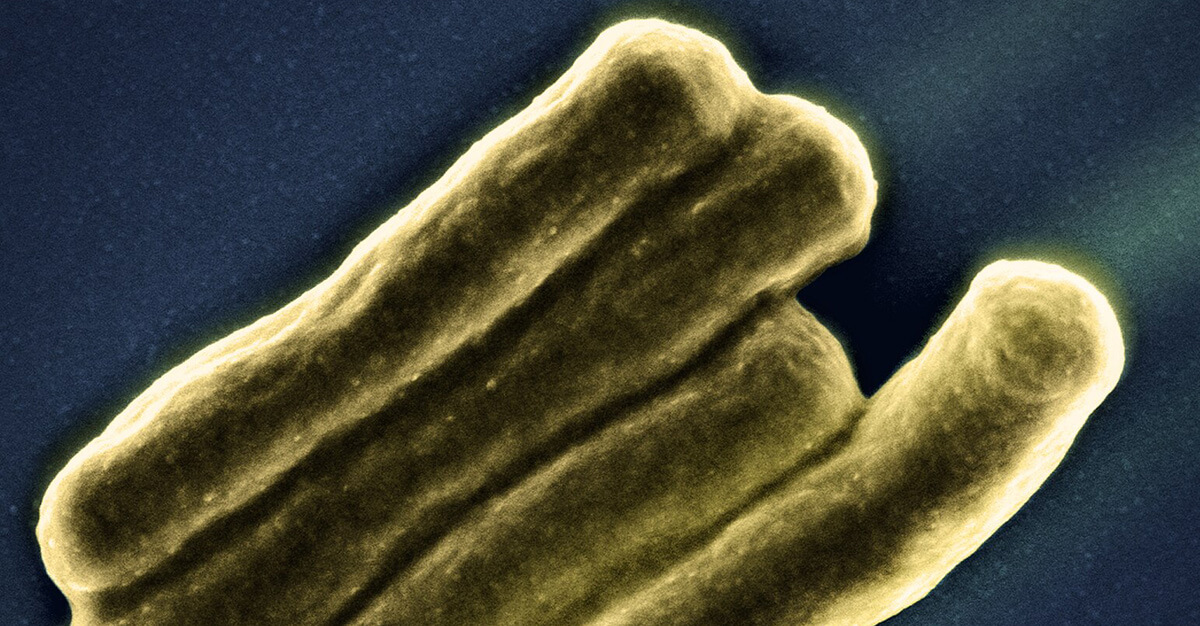 TB cases are disproportionately effecting the most vulnerable.