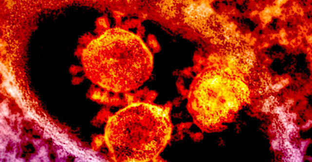 Colorized electron microscope image of virus particles in red and orange