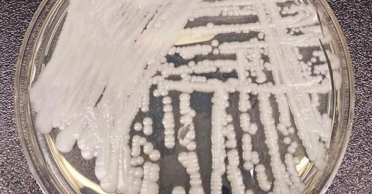 Candida auris is spreading in hospitals and other areas.