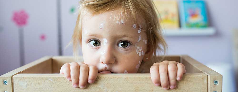 Chickenpox can be a very dangerous disease. Make sure your family is protected.