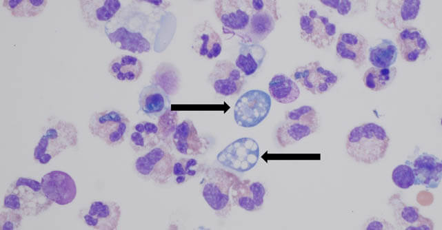 Free-living amoebas are tough microbes spreading as climate change reshapes environments.