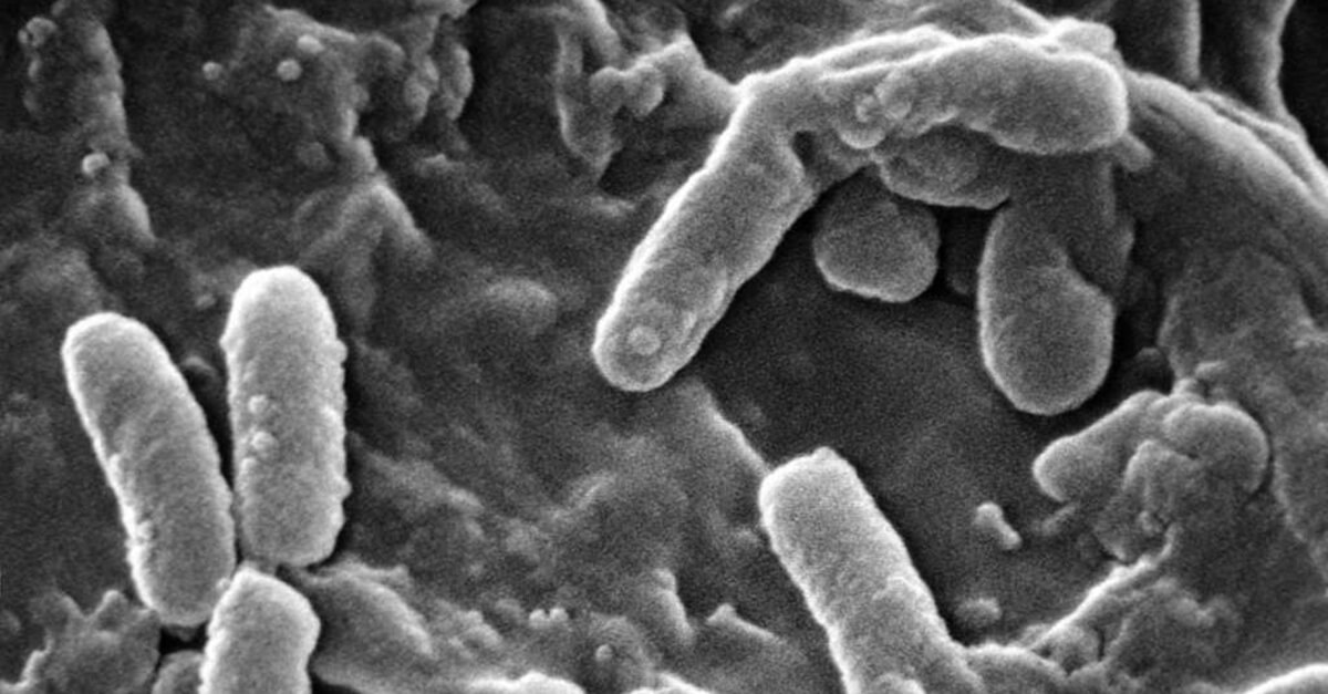 Pseudomonas aeruginosa