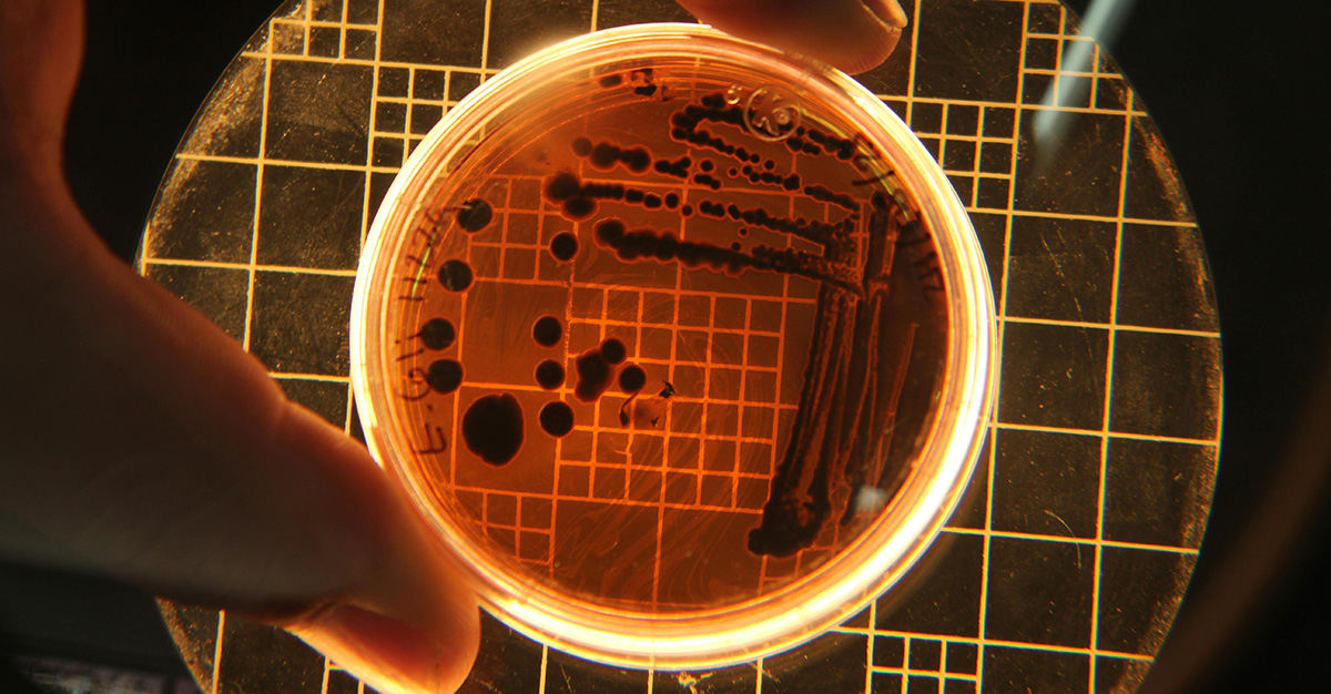 Bacterial Colonies Shown Under a Light