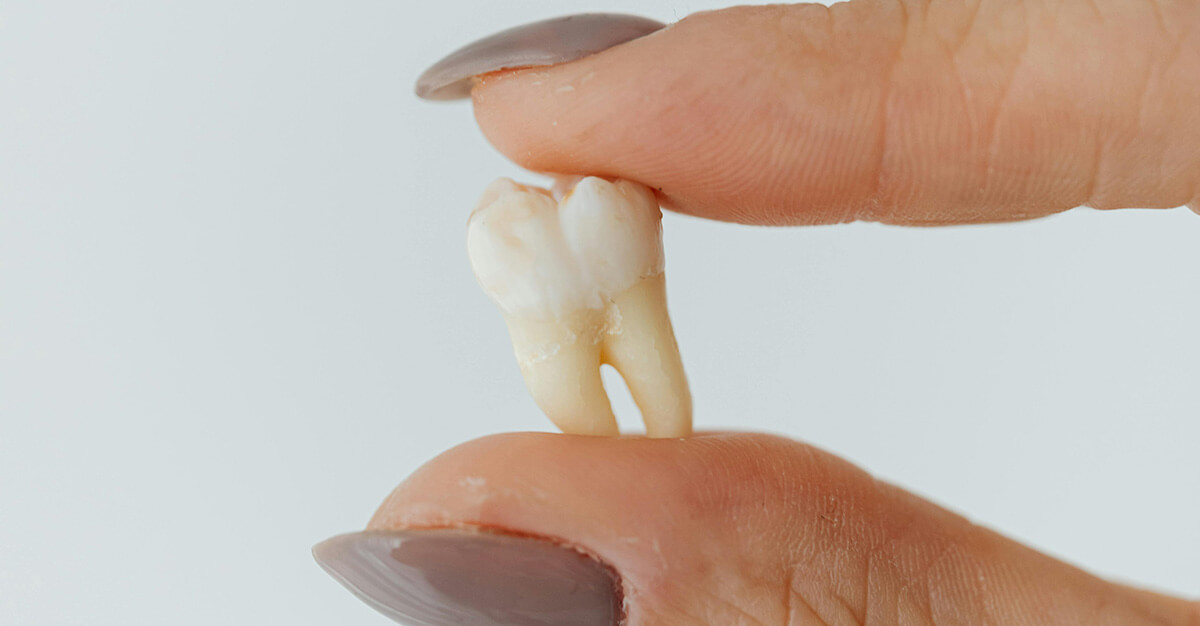 Close-Up Shot of a Person Holding a Tooth
